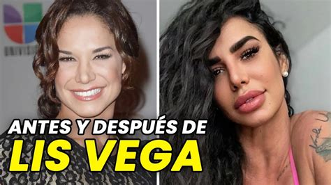 lis vega antes|Lis Vega: Antes y Después, 16 Fotos de su Evolución en la Pantalla